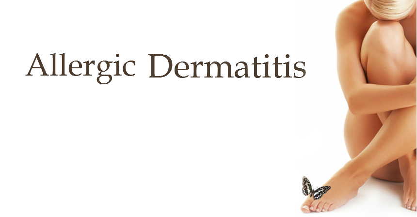 Allergic Dermatitis